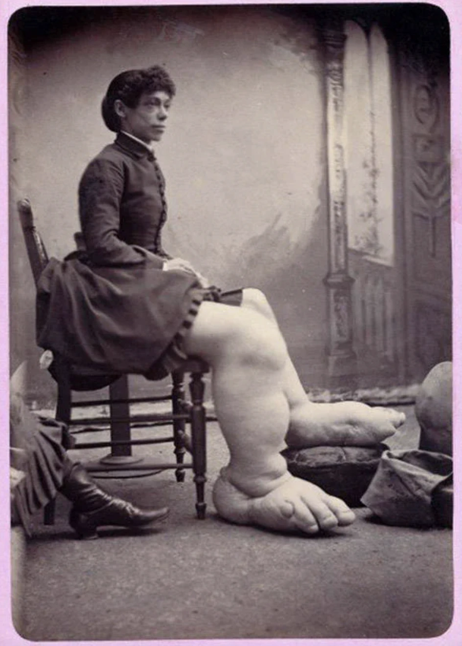 Step Right Up: A Collection of 24 Nostalgic Images Featuring Carnival and Circus Performances