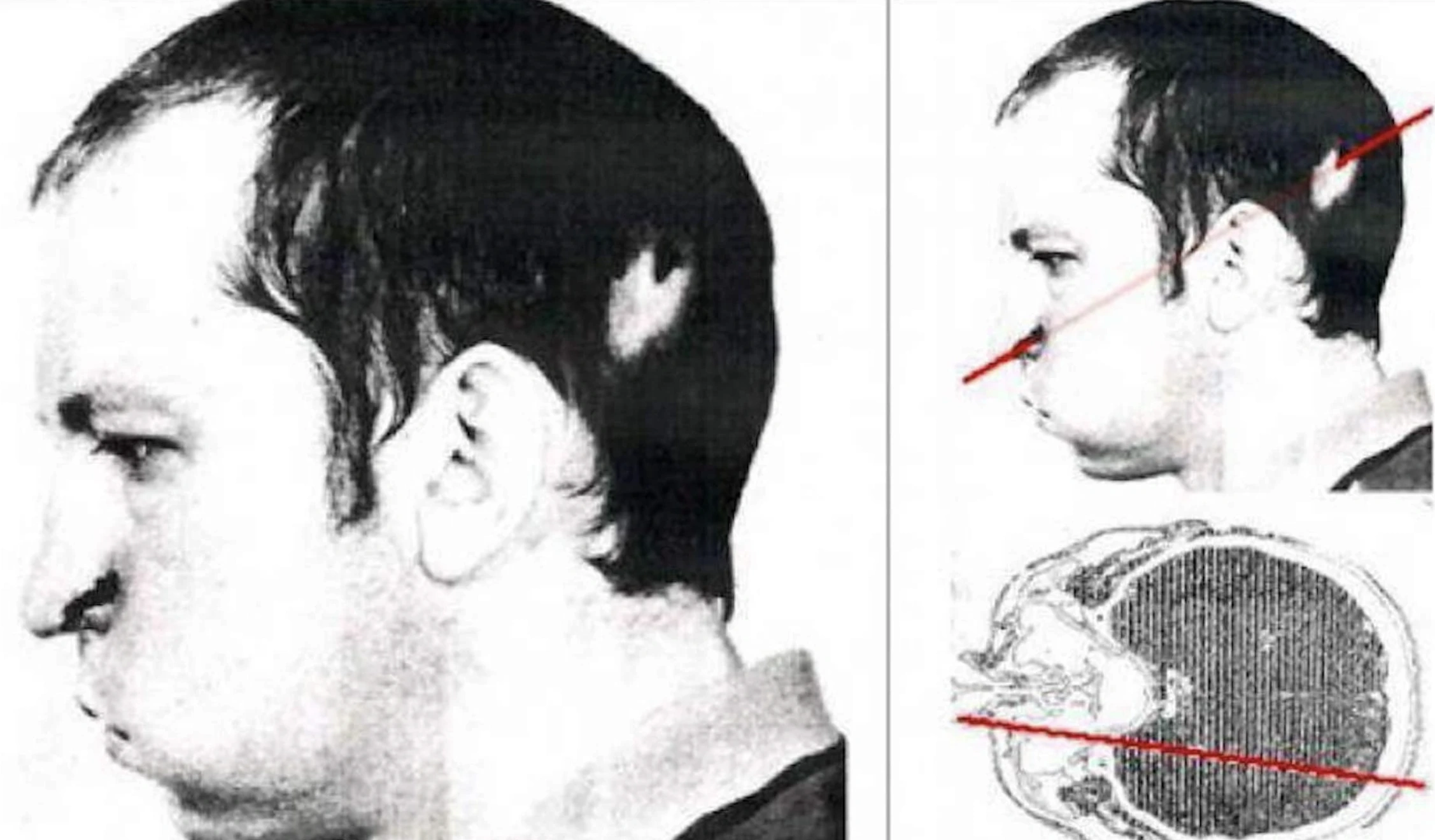 18 Mind-Blowing Achievements More Unlikely Than Walking on the Moon