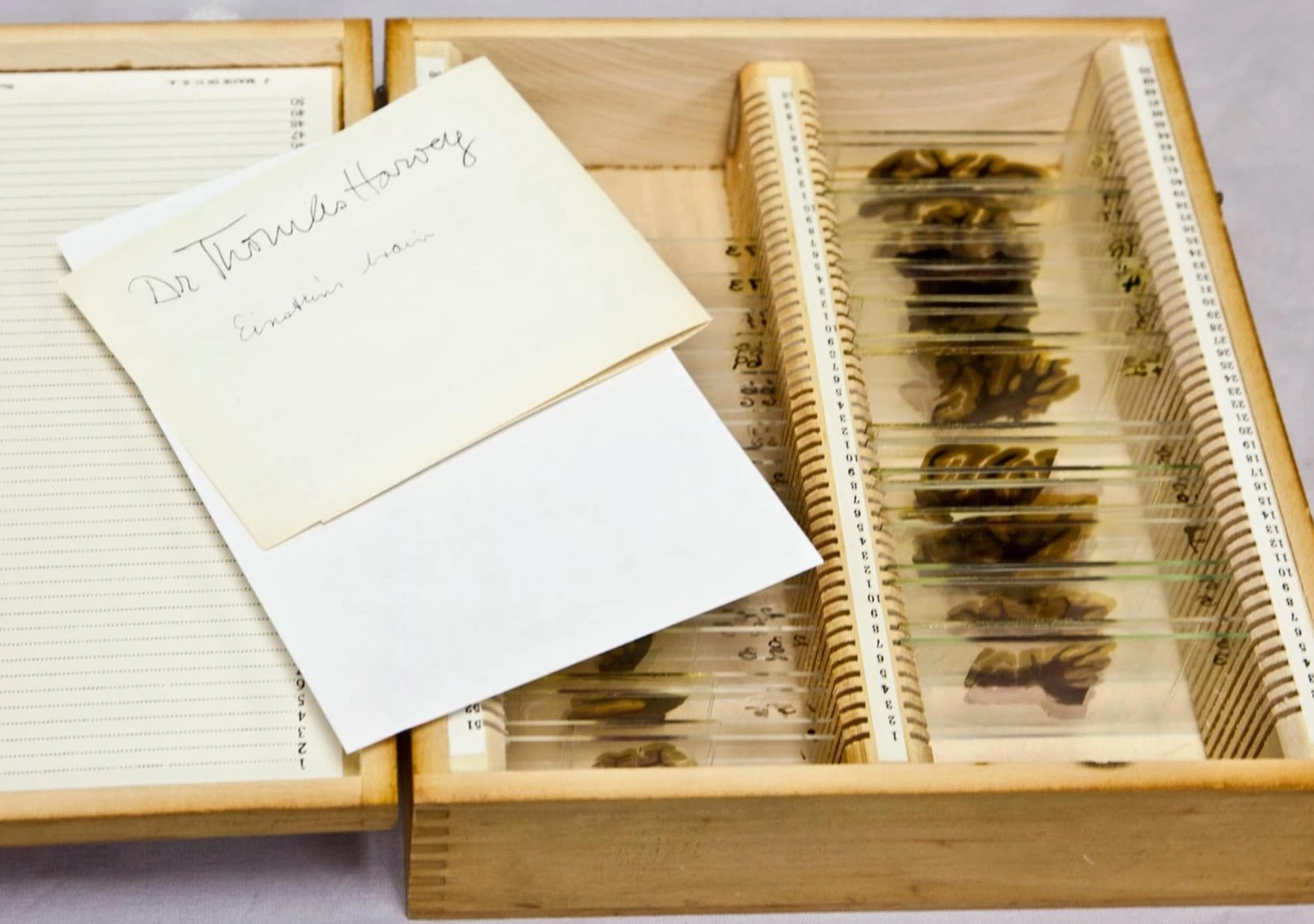 21 Bizarre and Unusual Exhibits Found in Museums Around the World