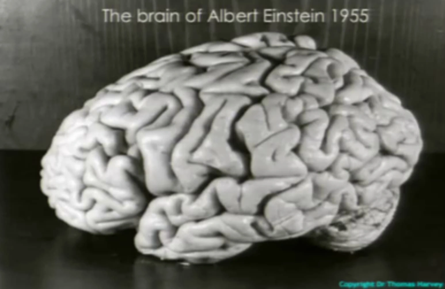Discover 20 Mind-Blowing Facts About Your Brain