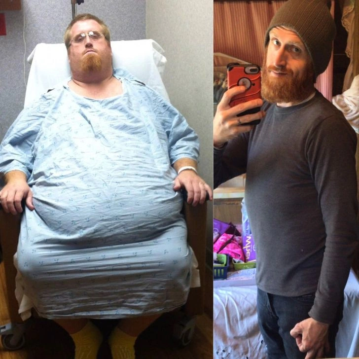 20 Individuals Who Underwent Incredible Body Transformations