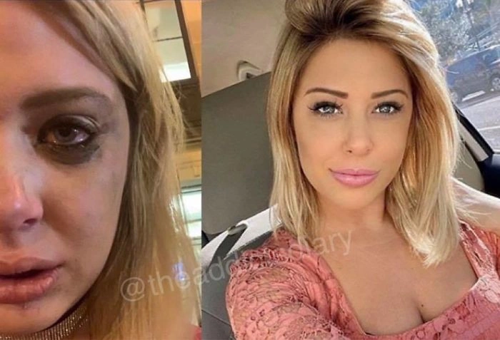 Transformation Tuesday: Incredible Before and After Photos of Individuals Who Overcame Drug Addiction