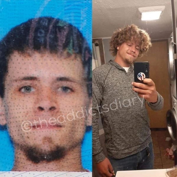 24 Jaw-Dropping Transformations of Recovered Addicts: Before and After
