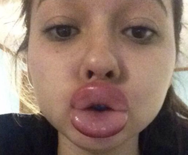 15 Ridiculous Fads that Took Social Media by Storm