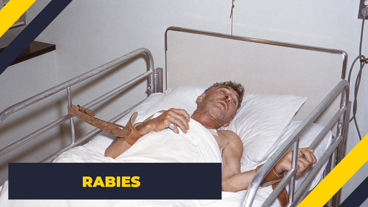 15 Terrifying Illnesses That Exist in Reality