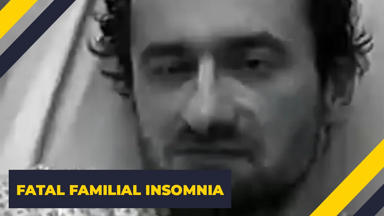 15 Terrifying Illnesses That Exist in Reality