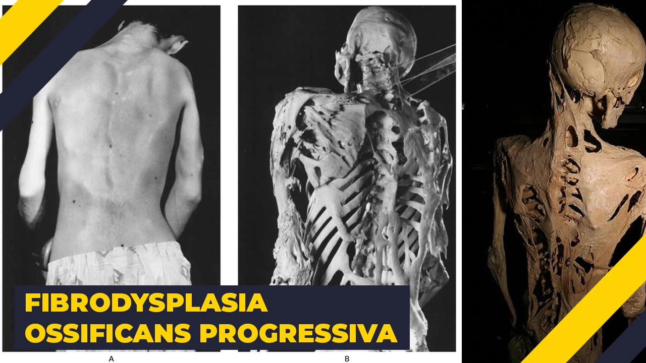 15 Terrifying Illnesses That Exist in Reality