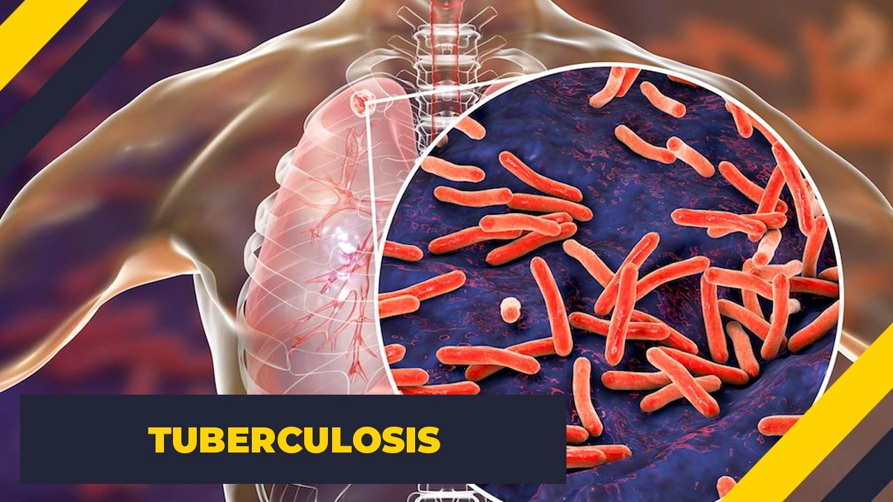 15 Terrifying Illnesses That Exist in Reality