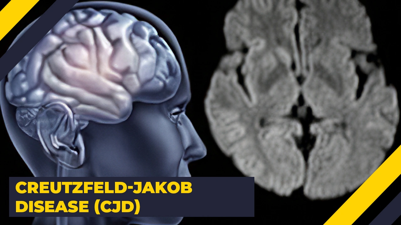 15 Terrifying Illnesses That Exist in Reality