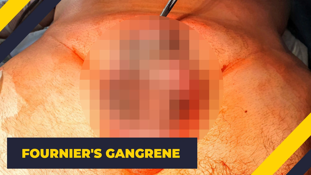 15 Terrifying Illnesses That Exist in Reality