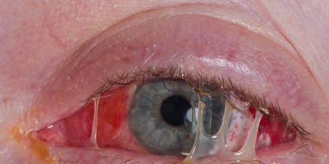 25 Excruciating Experiences That Are Just Shy of Death