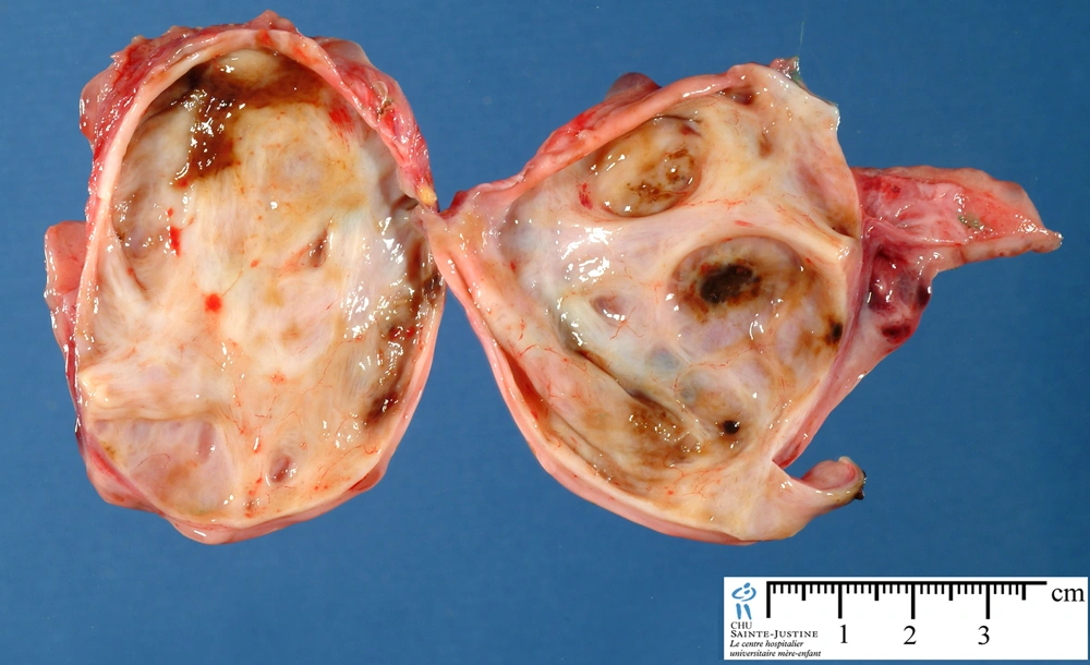 25 Excruciating Experiences That Are Just Shy of Death