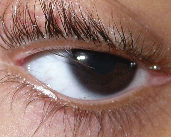 20 Small Injuries That Pack a Big Painful Punch