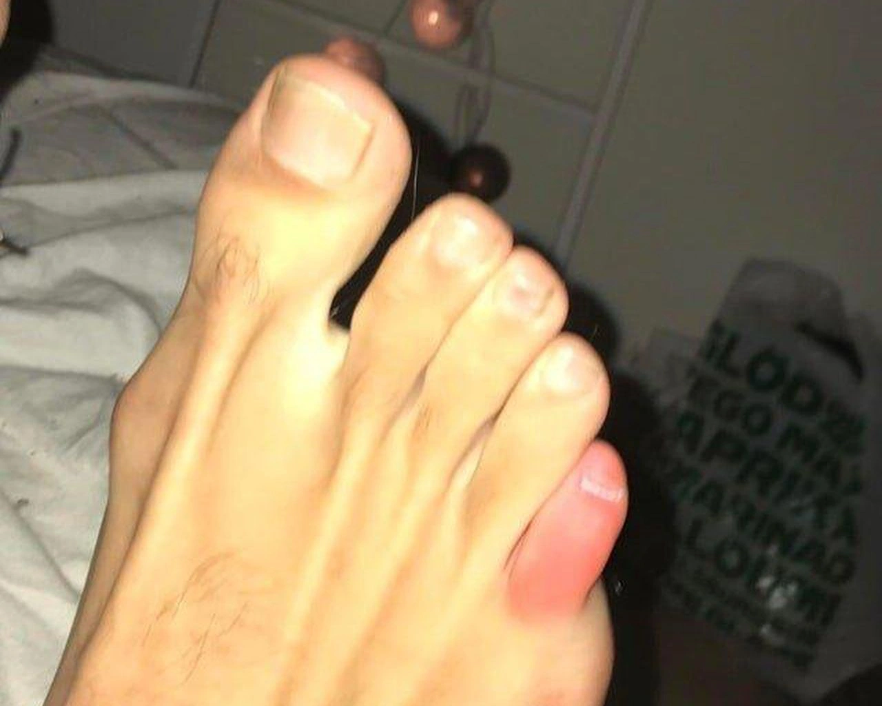 20 Small Injuries That Pack a Big Painful Punch