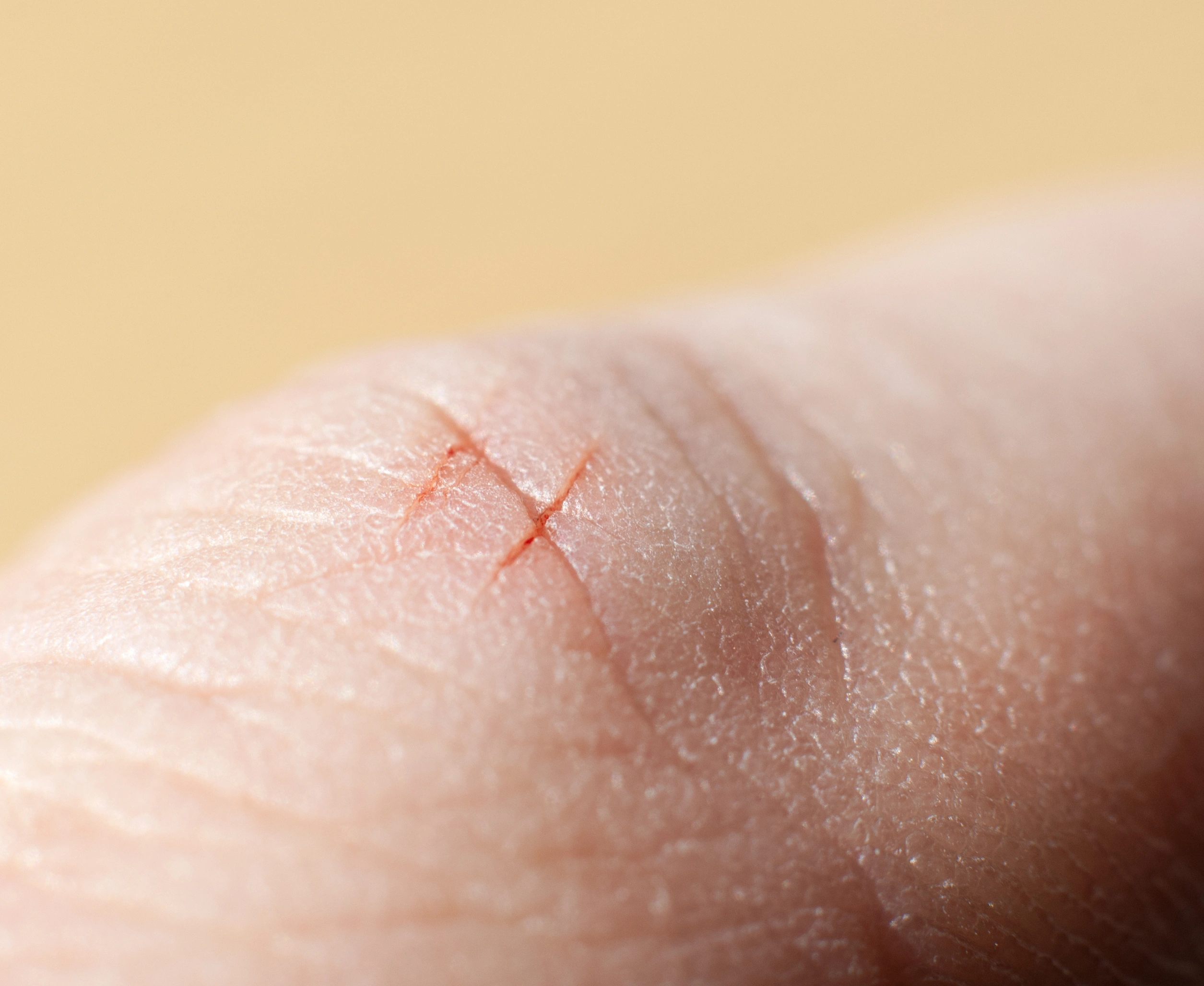 20 Small Injuries That Pack a Big Painful Punch