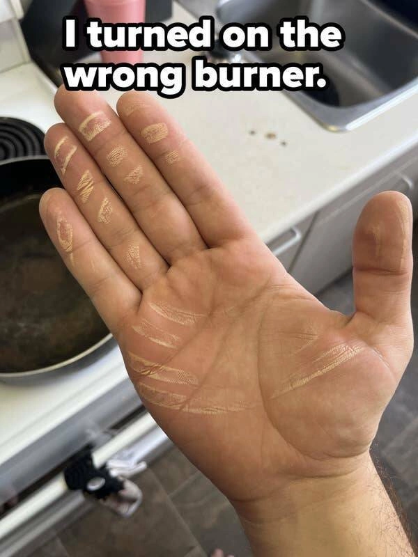 Whoops Wednesday: 21 Unfortunate Souls Who Were Hit by Bad Luck