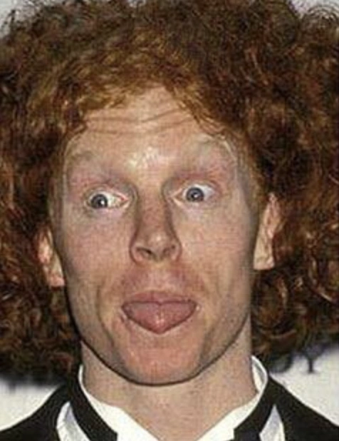 20 Stunning Transformations: Before and After Plastic Surgery of Celebrities