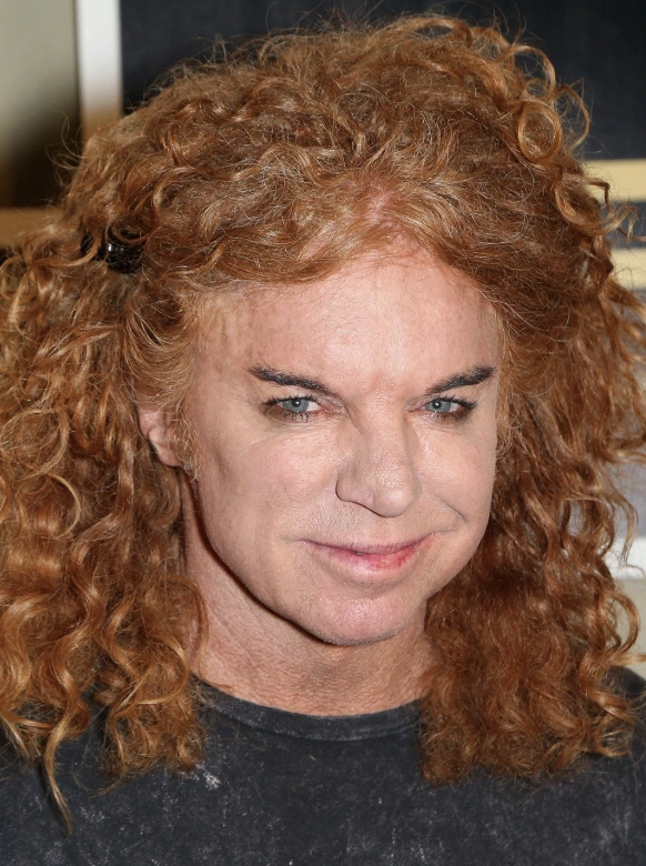 20 Stunning Transformations: Before and After Plastic Surgery of Celebrities