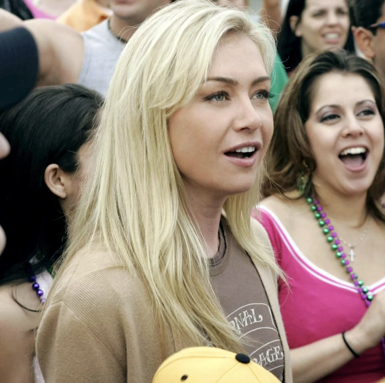 20 Stunning Transformations: Before and After Plastic Surgery of Celebrities