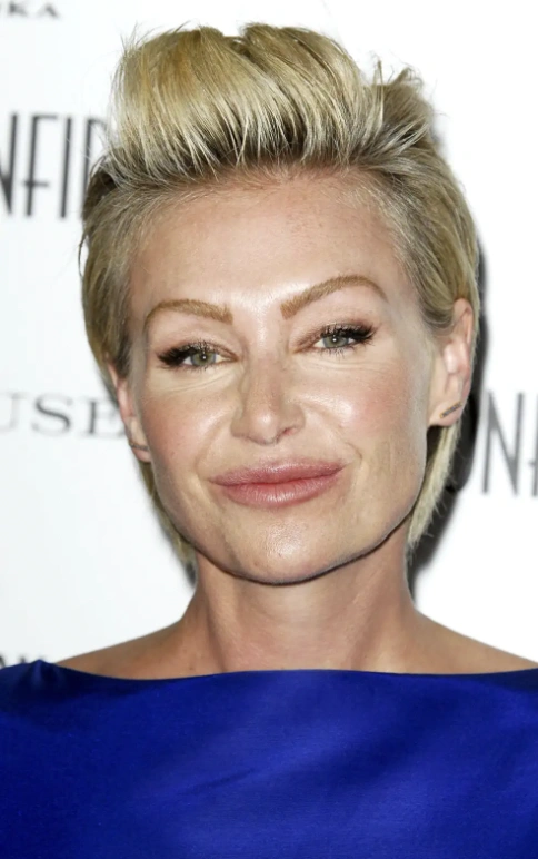 20 Stunning Transformations: Before and After Plastic Surgery of Celebrities