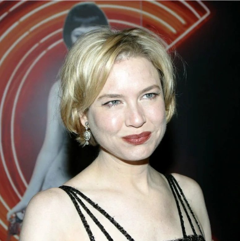 20 Stunning Transformations: Before and After Plastic Surgery of Celebrities