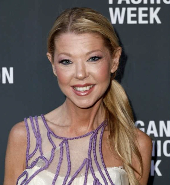 20 Stunning Transformations: Before and After Plastic Surgery of Celebrities