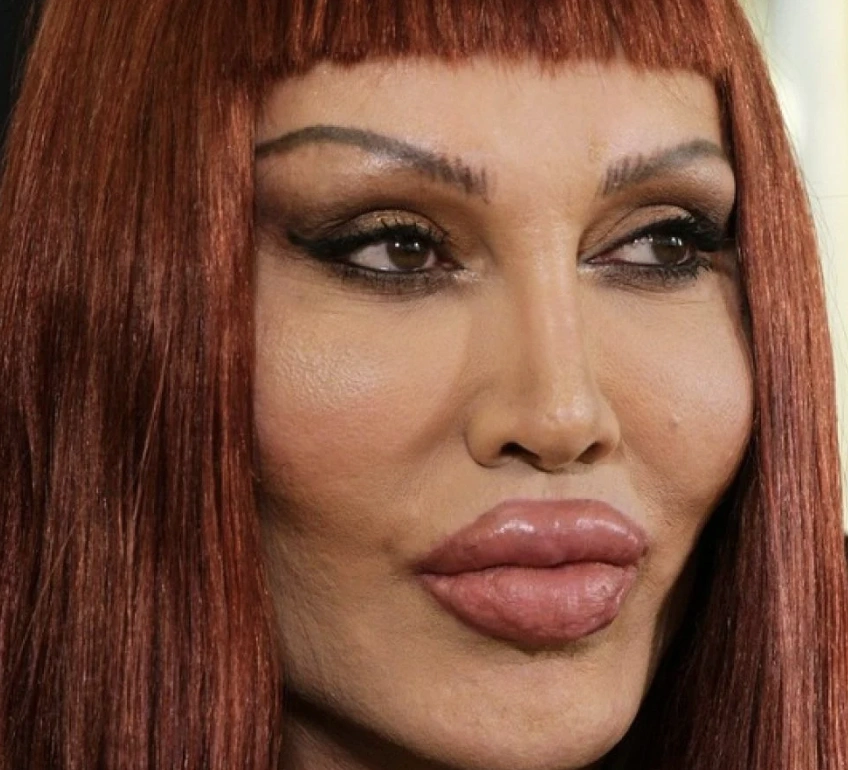 20 Stunning Transformations: Before and After Plastic Surgery of Celebrities