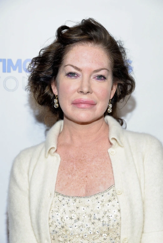 20 Stunning Transformations: Before and After Plastic Surgery of Celebrities