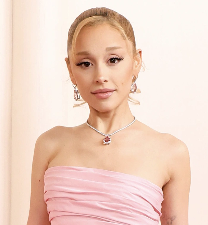 20 Stunning Transformations: Before and After Plastic Surgery of Celebrities