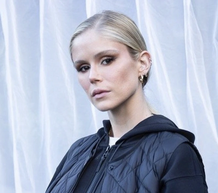 20 Stunning Transformations: Before and After Plastic Surgery of Celebrities