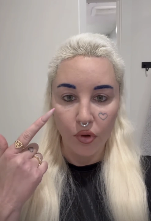 20 Stunning Transformations: Before and After Plastic Surgery of Celebrities