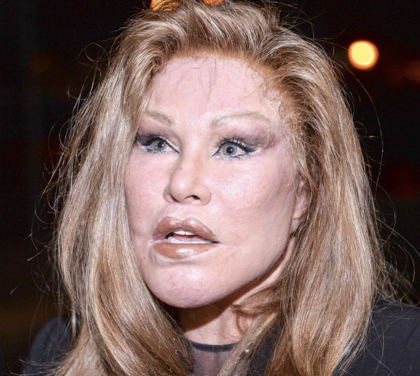 20 Stunning Transformations: Before and After Plastic Surgery of Celebrities