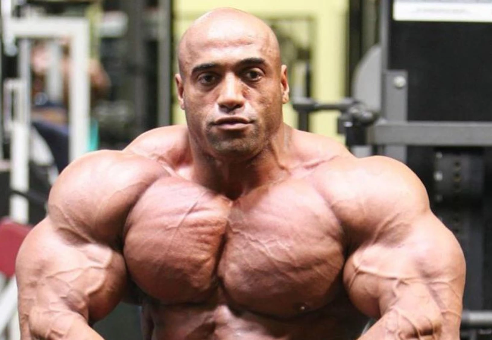 20 Bodybuilders on the Verge of Exploding
