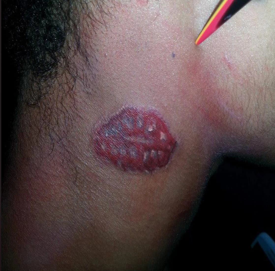 28 Tattoos That Unintentionally Resemble Anatomical Features