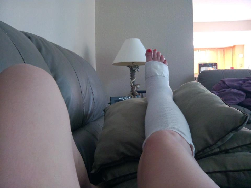 The Experience of Being Bitten by a Brown Recluse Spider