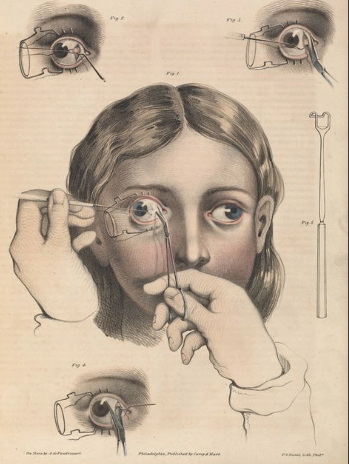 30 Retro Beauty Tools That Resemble Medieval Torture Devices
